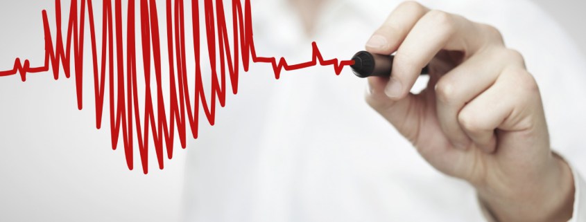 مانیتور ضربان قلب