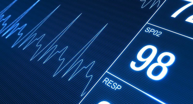 ماینتور ضربان قلب