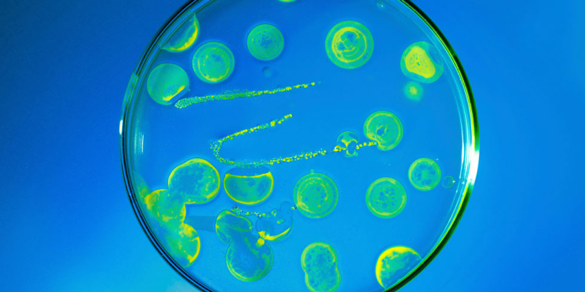 عفونت باکتریایی