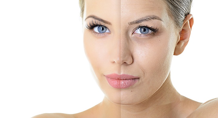 فواید آلوئه ورا