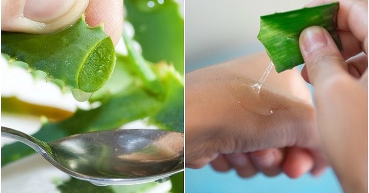 گیاه آلوئه ورا