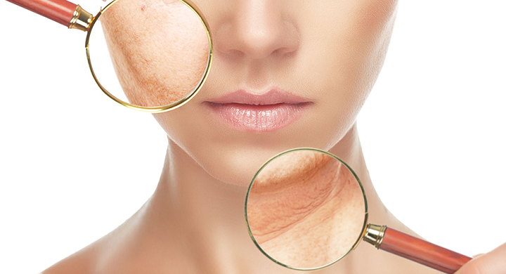 مشکل چروک پوست